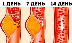 Что такое здоровая диета и как ее придерживаться для улучшения здоровья?