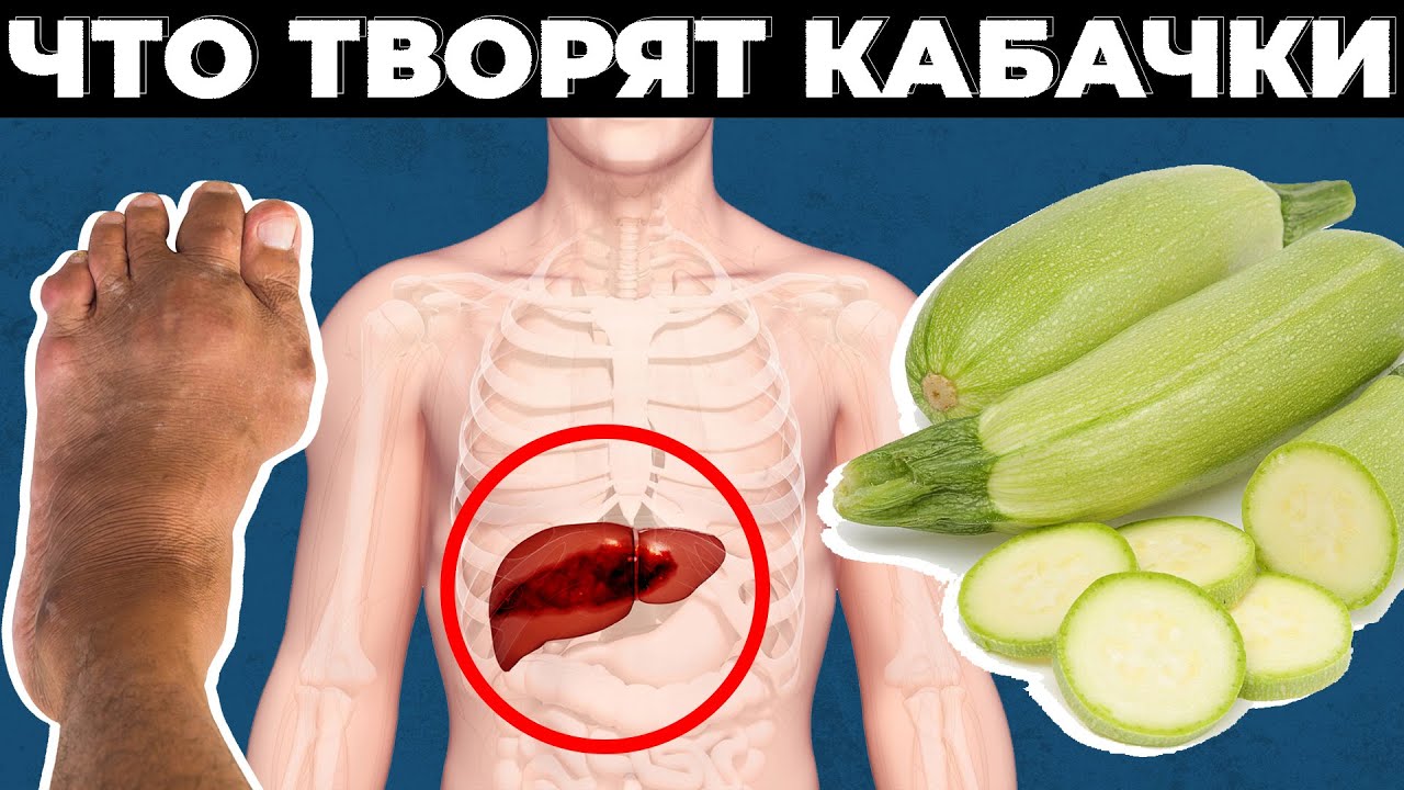 Польза и вред кабачков