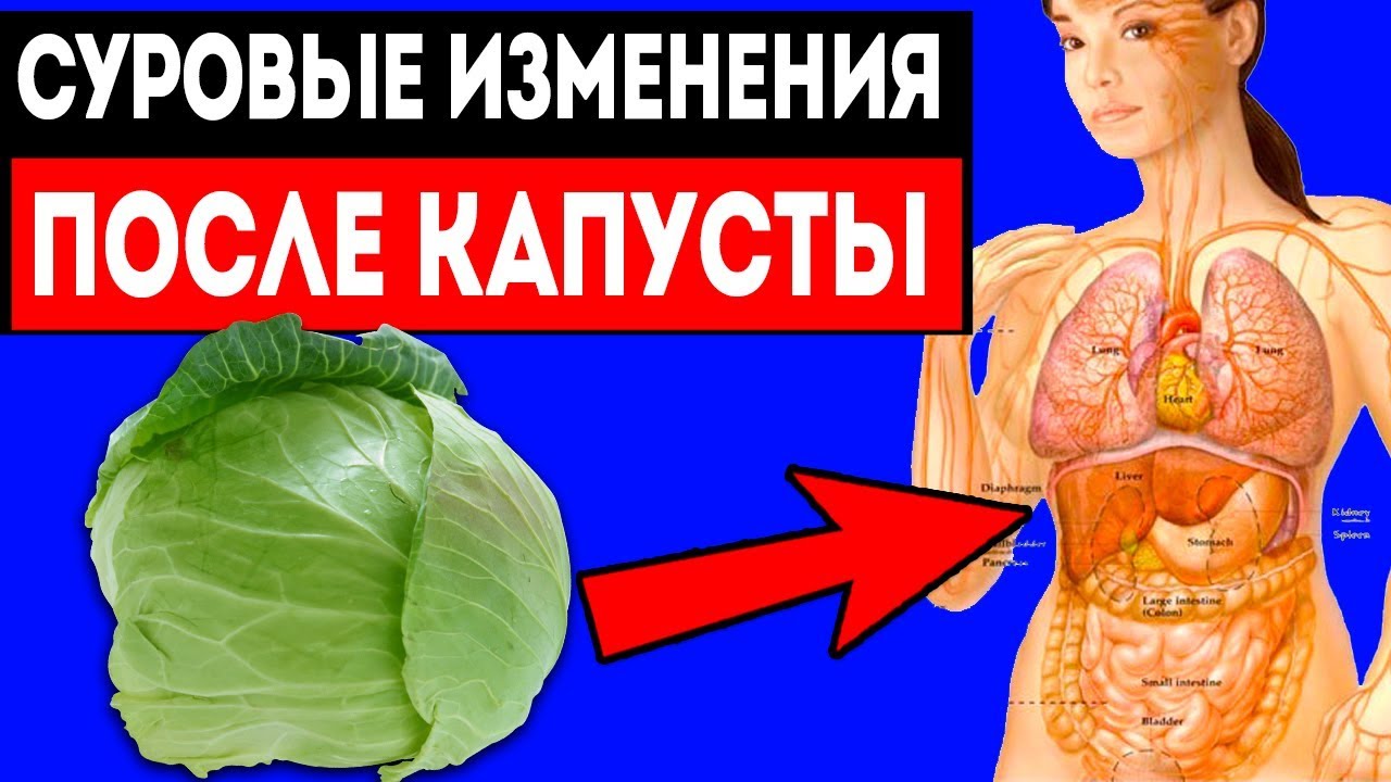 Что будет, если есть капусту каждый день?