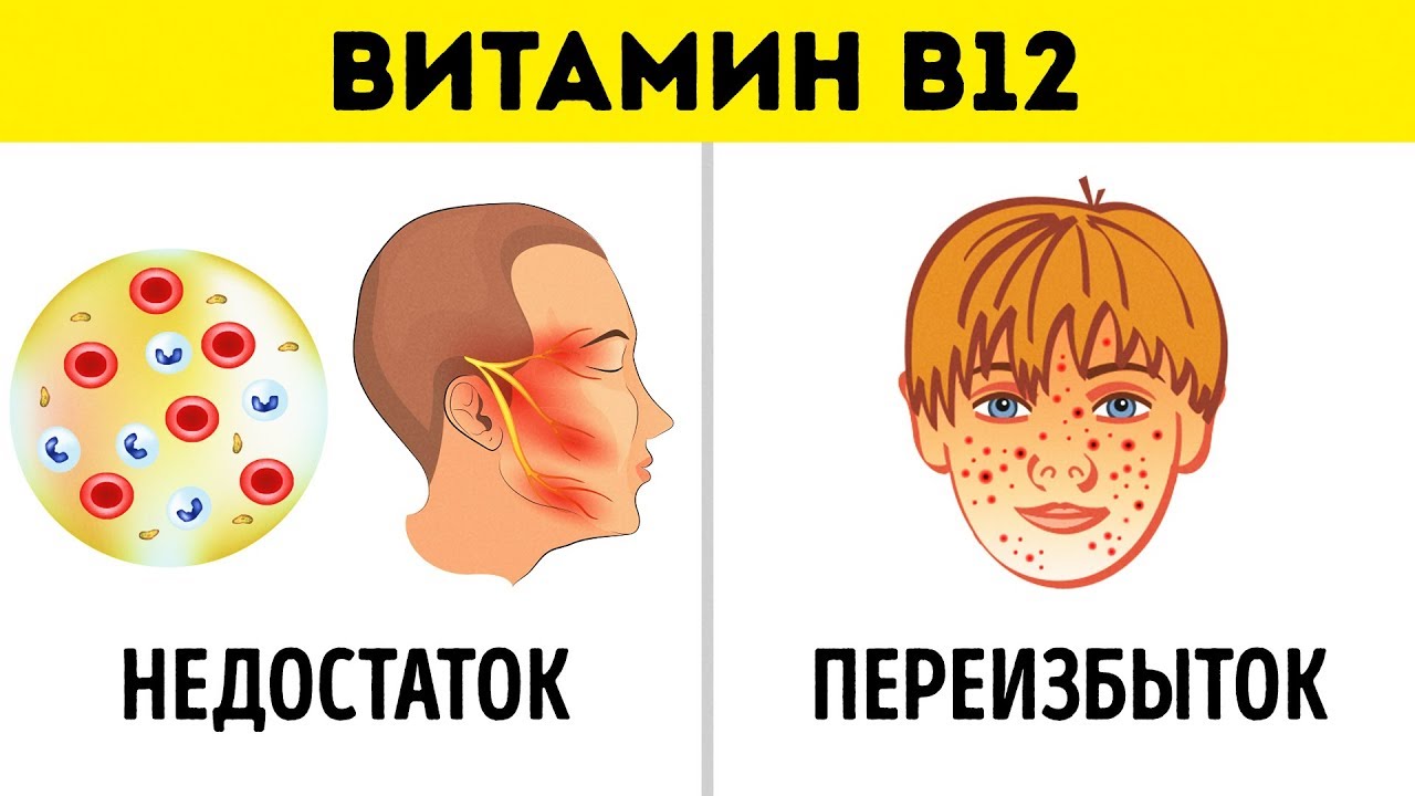 Как правильно пить витамины?