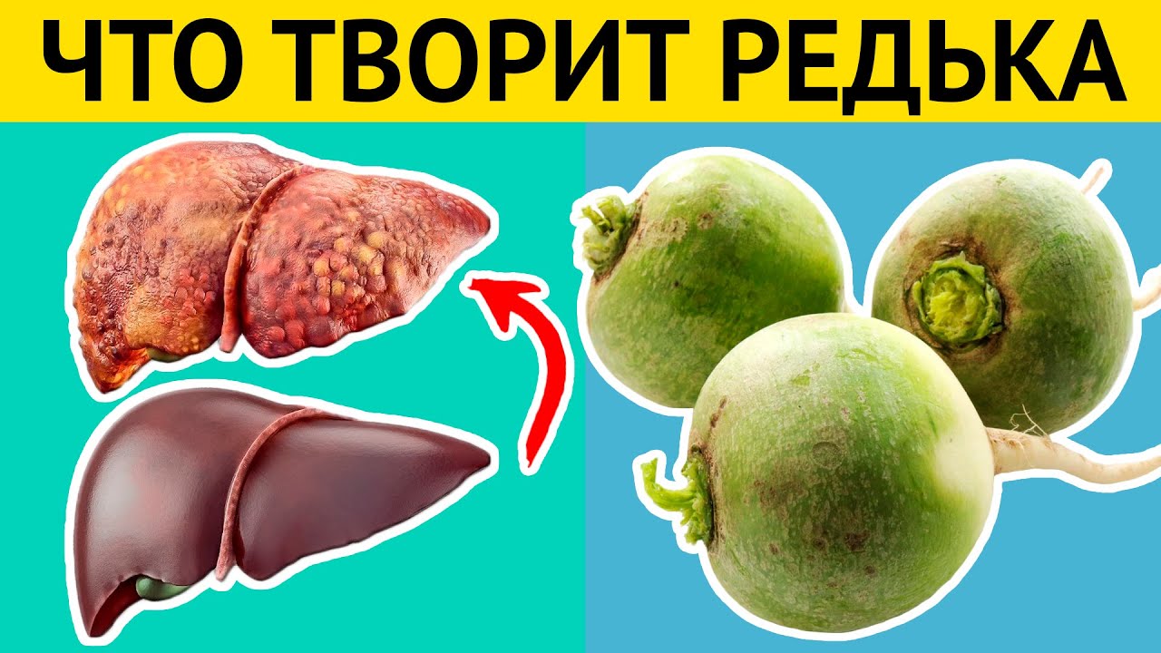 Польза и вред зеленой редьки