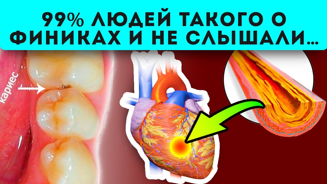 Польза и вред фиников