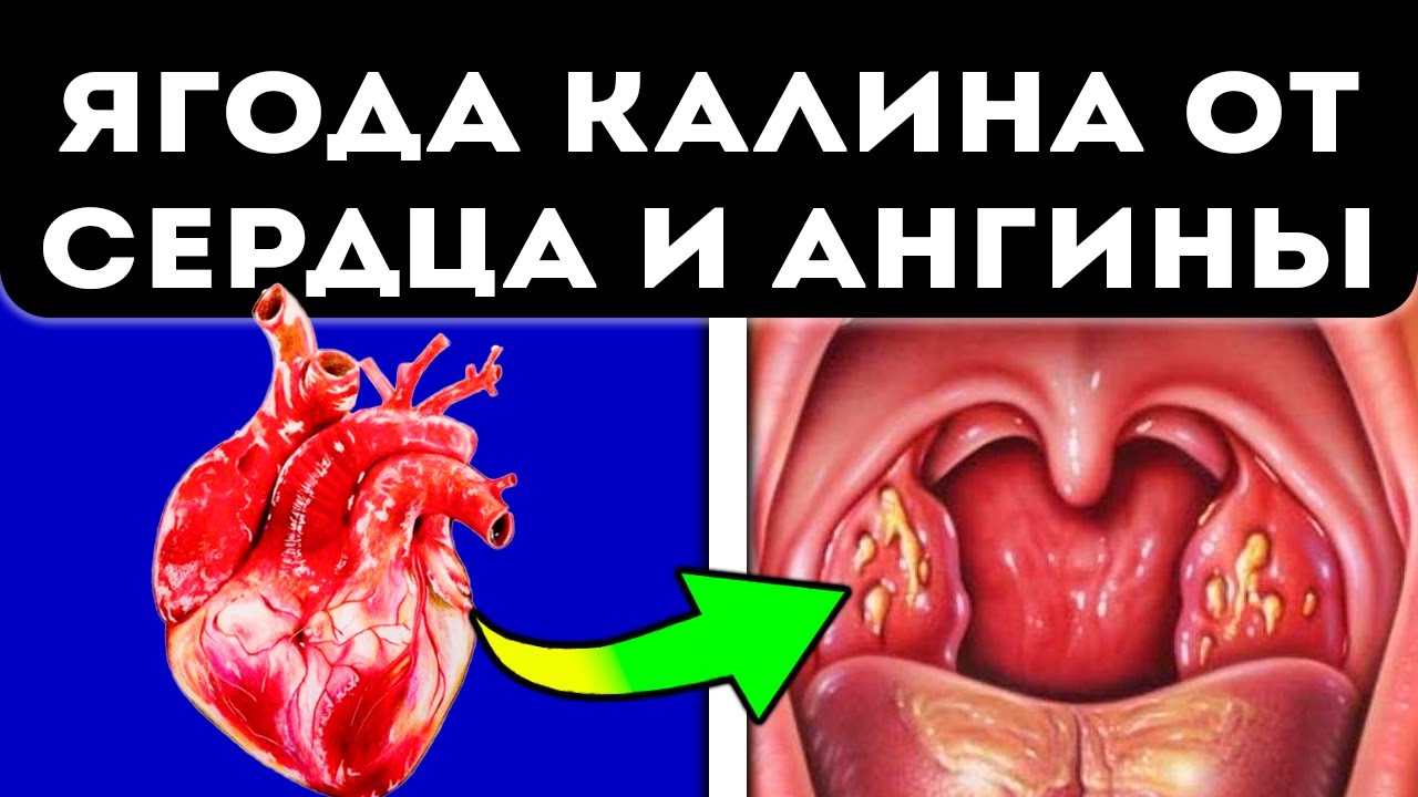 12 причин выпить чай с калиной