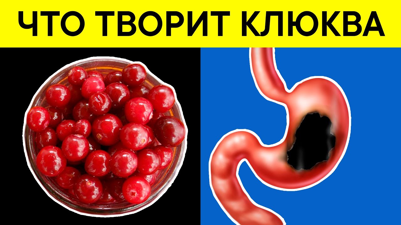 Полезные свойства клюквы 