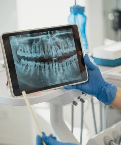 рентген ротовой полости